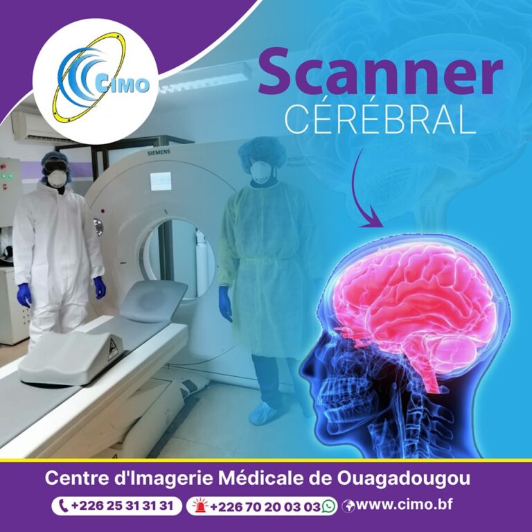 scanner-c-r-bral-cimo
